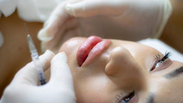 lip filler, beauty, injection-6485474.jpg